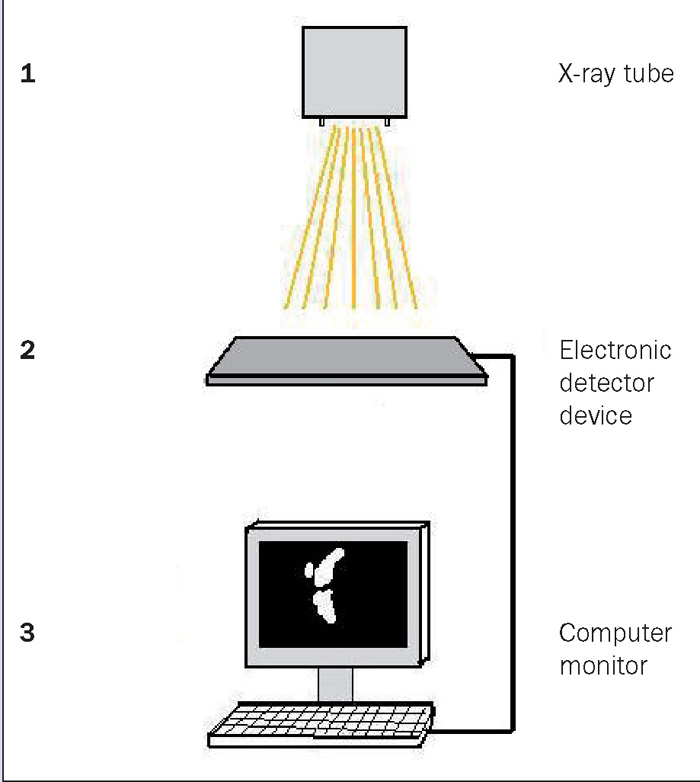 pdf-comparison-between-conventional-radiography-and-radiovisiography