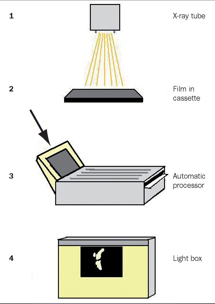 CONTRASTING VIEWS – DIGITAL VS CONVENTIONAL RADIOGRAPHY | Vet Times