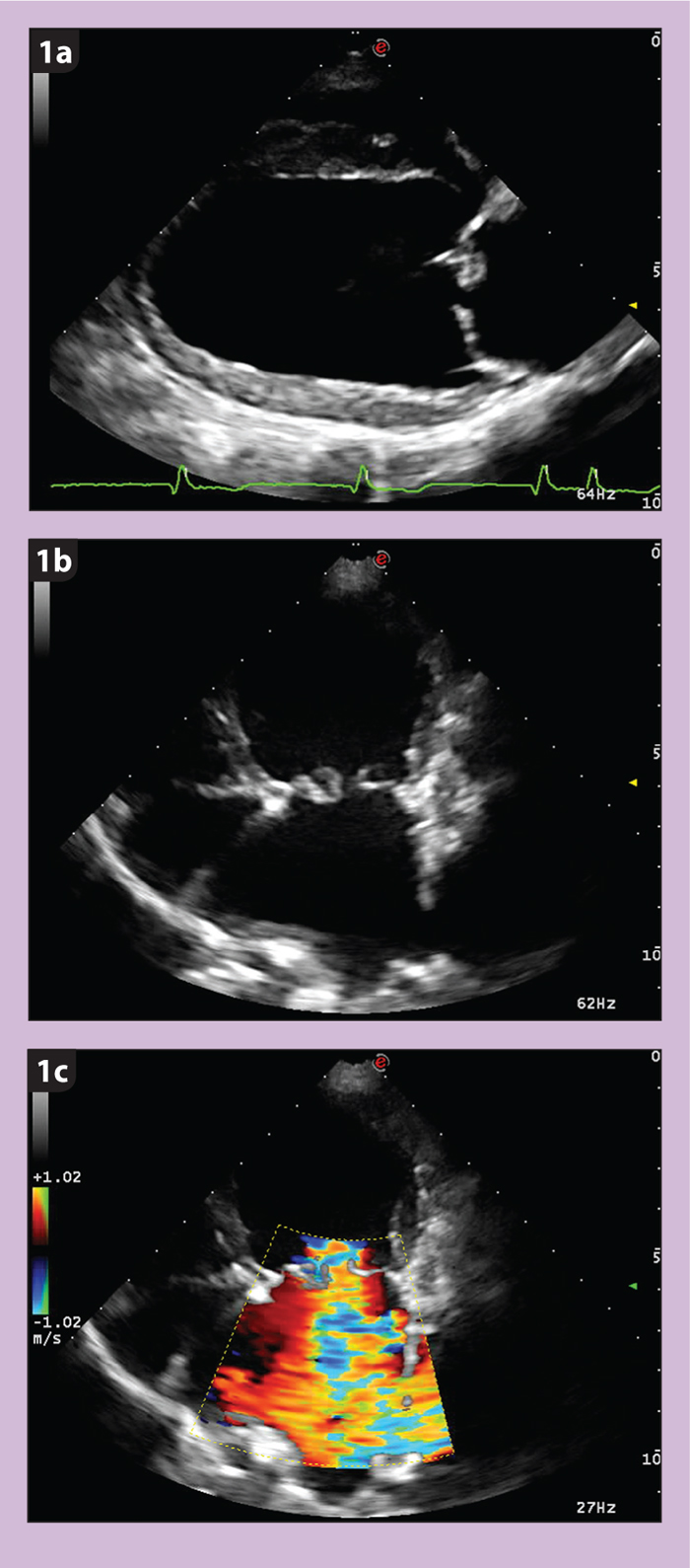 Advances in canine cardiology | Vet Times