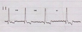 ECG from a dog with AF