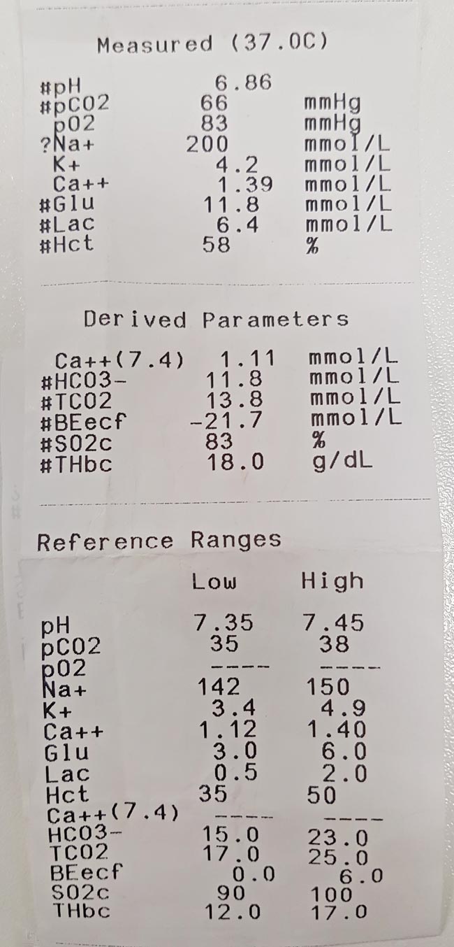 The patient’s blood gas analysis and electrolyte panel. Note the sodium concentration.