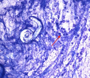 Images from a bronchoalveolar lavage of an adult male dog.