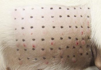 Allergen-specific immunotherapy remains the only disease-modifying treatment option, with new delivery methods such as intralymphatic treatment under investigation.