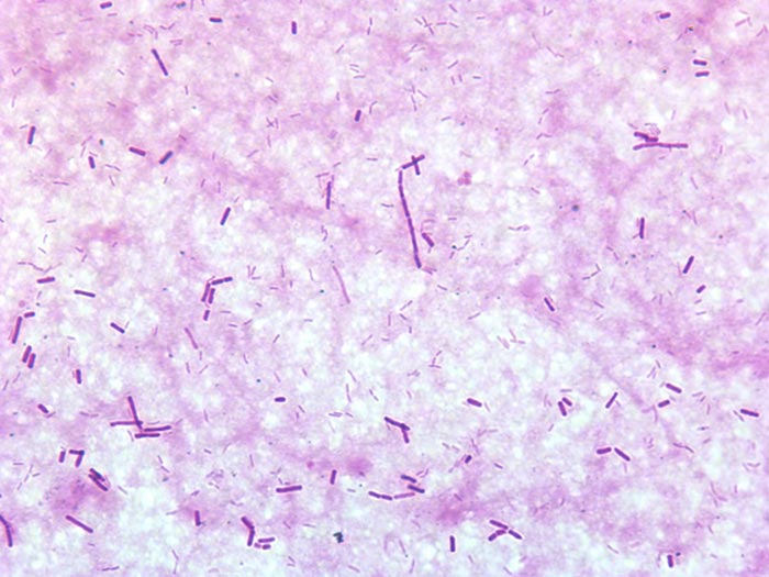 <em>Clostridium perfringens<em>.