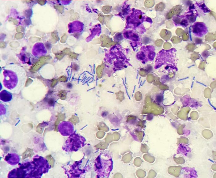 Detection of bacteria found after performing a fine needle aspirate.