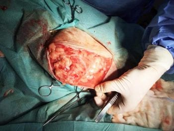 Figure 4. The omentum wrapped around the muscle of the hindlimb. 