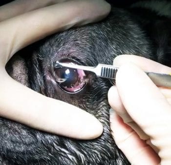 Figure 4. Application of a bandage contact lens after corneal debridement using a diamond burr.