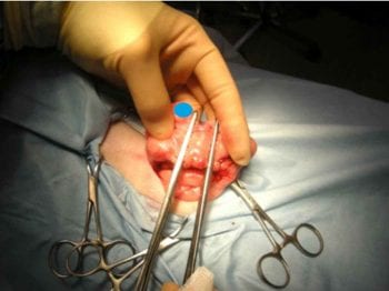 Figure 15. A second pair of artery forceps are placed on the uterine horn 15mm to 20mm distal to the first. The blue circle shows the position of the ovary (head end is left).