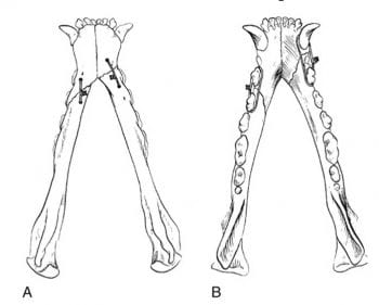 Figure 5. Dorsal (left) and ventral (right) views of a rostral stable bilateral body fracture treated with both interfragmentary and interdental wires. Image: DeCamp et al, 2016.