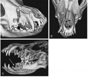 Figure 2. CT images showing comminuted maxillary fracture. Image: DeCamp et al, 2016.