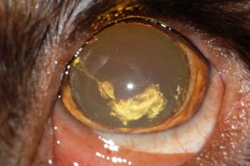 Figure 10. Left eye immature nuclear cataracts in a two-year-old cocker spaniel. These lens changes were most likely congenital in combination with an abnormally small globe as part of a multiple ocular defect syndrome.