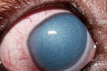 Figure 9. Right eye acute primary closed angle glaucoma in a five-year-old basset hound.
