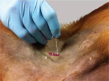 Figure 3. The position of the needle to perform a saphenous nerve block. 1 = location in which the femoral artery is palpated; 2 = pectineus muscle; 3 = penis.