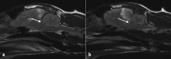 Figure 3. (a) Midline sagittal and (b) parasagittal T2-weighted images of Flash’s head. These images showed a caudal transtentorial brain herniation of the cerebrum (parahippocampal gyrus; white arrows).
