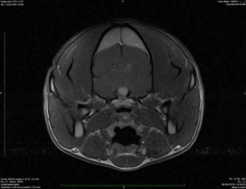 Figure 3a. Transverse images of the brain: this one is T1w.