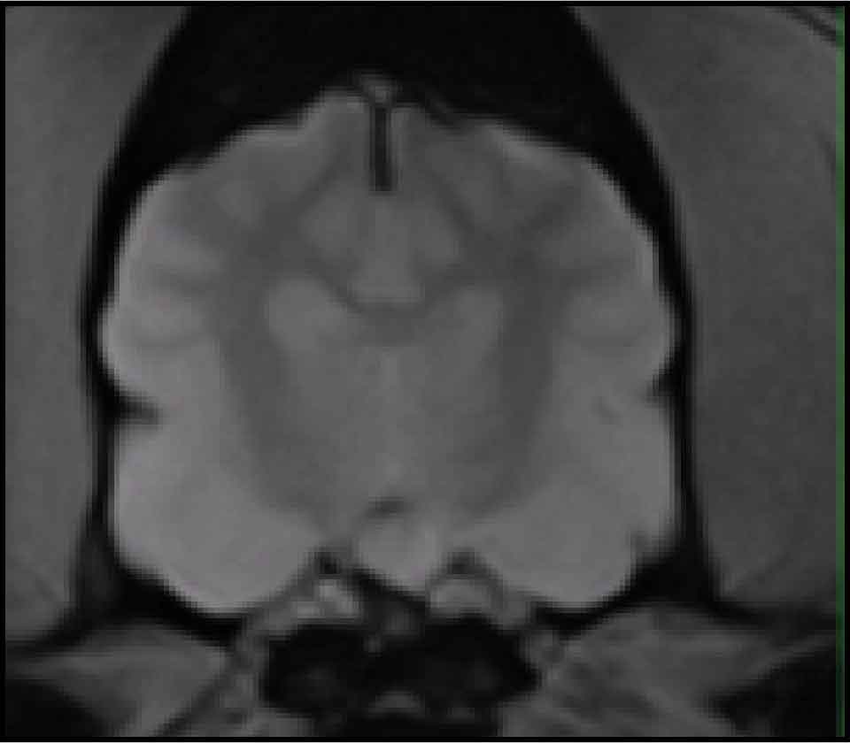 A case of diabetes insipidus caused by hypothalamic mass   Vet Times