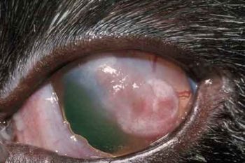 Figure 5. Eosinophilic keratoconjunctivitis, left eye.