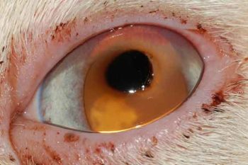 Figure 6. Dense central corneal sequestrum.