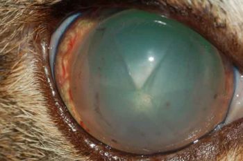Figure 8. Anterior lens luxation.