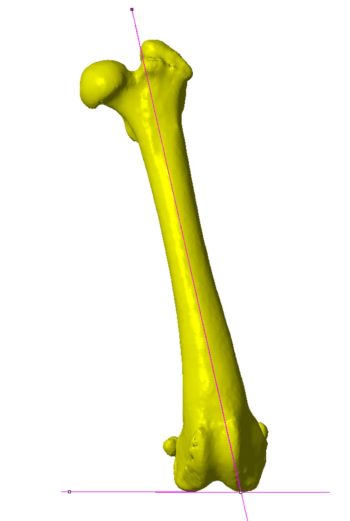 Figure 1. A volume-rendered CT image with lines drawn showing the measurement of the anatomic lateral distal femoral angle. Image: Bill Oxley, Vet 3D
