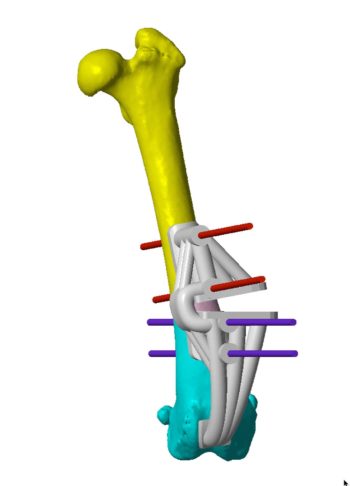 Figures 2 and 3. Computer-aided design images showing the virtual osteotomy and guides required to perform this osteotomy. Image: Bill Oxley,Vet 3D
