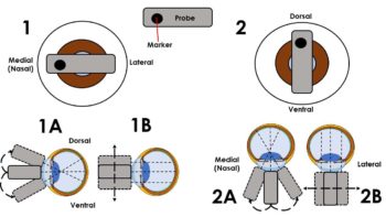 Figure 3. This schematic illustration shows the orientation of the probe in a horizontal (1) and vertical (2) plane, with the corresponding position of the probe marker. Below each image, the diagrams show the movement of the probe used in each orientation to examine the ocular structures. 1a and 2a show the fanning (angulation) movement used. 1b and 2b show the sliding motion of the probe on the ocular surface.