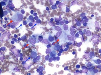 Figure 2. Fine needle aspirates from the left prescapular lymph node in an adult English springer spaniel dog (Wright-Giemsa, 50×).