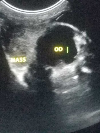 Figure 3. Ultrasound imaging of a retrobulbar mass, confirming a diagnosis of exophthalmos (see also Figure 5).
