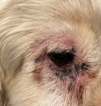 Figure 12. Local drug allergic reaction.