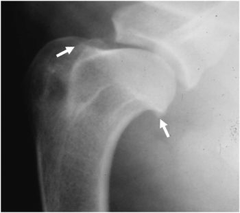 Figure 2 (left). Osteophytosis of the canine shoulder joint – these changes are non-specific and may be clinically insignificant.