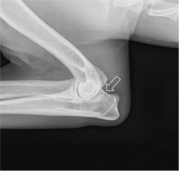 Figure 3a. Flexed mediolateral view highlighting proximal border of anconeal process.
