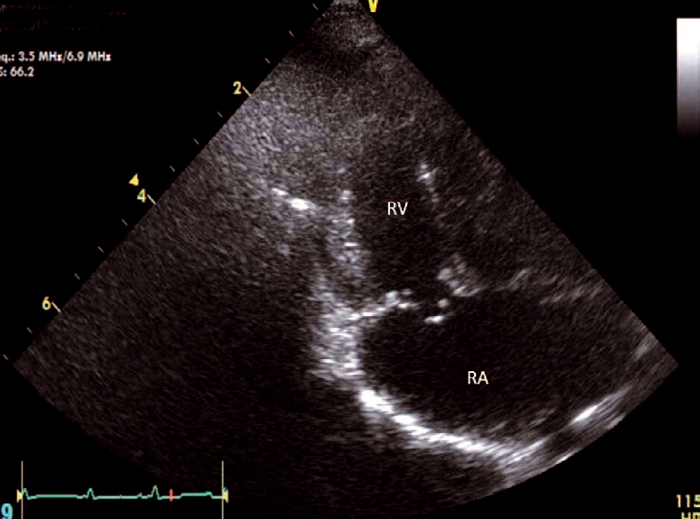 CANINE ACQUIRED HEART DISEASE: ADVANCES IN MEDICAL TREATMENT | Vet Times